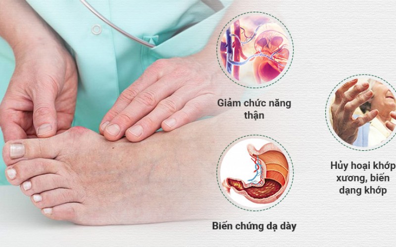 Người bị bệnh Gout có ăn được tổ yến không?